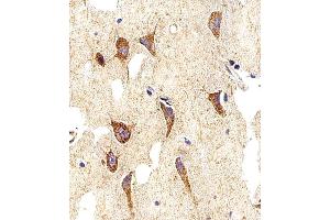 Immunohistochemical analysis of paraffin-embedded H. (Myosin 抗体  (AA 654-668))