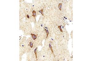 Immunohistochemical analysis of paraffin-embedded H. (Myosin 抗体  (AA 654-668))