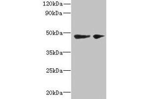 Western blot All lanes: SLC25A46 antibody at 6 μg/mL Lane 1: Mouse brain tissue Lane 2: Jurkat whole cell lysate Secondary Goat polyclonal to rabbit IgG at 1/10000 dilution Predicted band size: 47, 31, 38 kDa Observed band size: 47 kDa (SLC25A46 抗体  (AA 1-102))