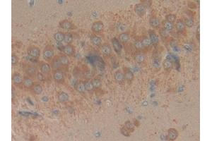 Detection of RPRM in Rat Brain Tissue using Polyclonal Antibody to Reprimo (RPRM) (Reprimo 抗体  (AA 1-109))