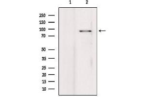 Western Blotting (WB) image for anti-Progesterone Immunomodulatory Binding Factor 1 (PIBF1) (C-Term) antibody (ABIN6266307)