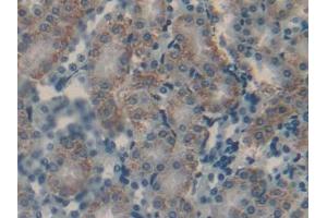 Detection of CGa in Mouse Kidney Tissue using Polyclonal Antibody to Chorionic Gonadotropin Alpha Polypeptide (CGa) (CGA 抗体  (AA 25-120))