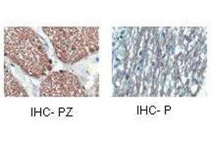 CNP antibody staining of oligodendrocyte lineage cells in the human optic nerve and/or spinal cord. (Cnpase 抗体  (Middle Region))