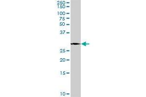 PLP1 MaxPab rabbit polyclonal antibody. (PLP1 抗体  (AA 1-277))