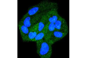 Immunofluorescence (Cultured Cells) (IF (cc)) image for anti-Signal Transducer and Activator of Transcription 6, Interleukin-4 Induced (STAT6) antibody (ABIN5557533)