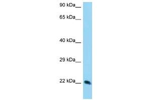 WB Suggested Anti-TSN Antibody Titration: 1. (Translin 抗体  (Middle Region))