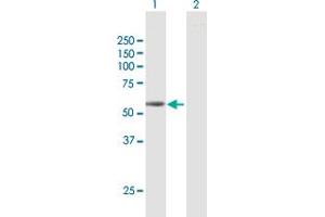 Western Blotting (WB) image for anti-Sema Domain, Transmembrane Domain (TM), and Cytoplasmic Domain, (Semaphorin) 6D (SEMA6D) (AA 1-476) antibody (ABIN529176)