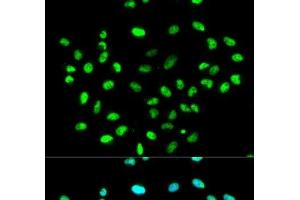 Immunofluorescence analysis of MCF-7 cells using HNRNPK Polyclonal Antibody (HNRNPK 抗体)