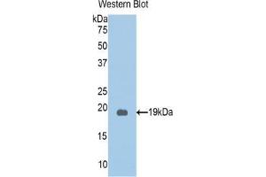 Western blot analysis of the recombinant protein. (PKN2 抗体  (AA 323-464))