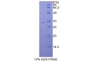 SDS-PAGE analysis of Mouse Myosin IB Protein. (Myosin IB Protein (MYO1B))
