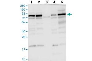 Western blot analysis of Lane 1: RT-4, Lane 2: U-251 MG, Lane 3: Human Plasma, Lane 4: Liver, Lane 5: Tonsil with DENND1C polyclonal antibody  at 1:100-1:250 dilution. (DENND1C 抗体)