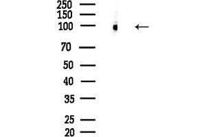 Western blot analysis of lysates from Hela cells(LPS,4h treatment), using Phospho-Progesterone Receptor (Ser190) Antibody at 1/1000 dilution.