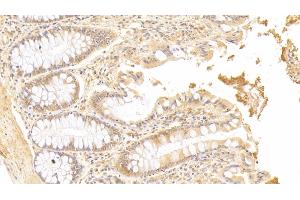 Detection of SMOX in Human Colon Tissue using Polyclonal Antibody to Spermine Oxidase (SMOX) (SMOX 抗体  (AA 1-165))