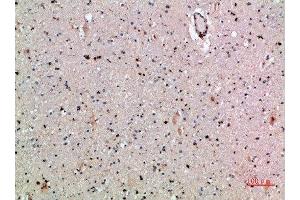 Immunohistochemical analysis of paraffin-embedded human-brain, antibody was diluted at 1:200 (CLEC4A 抗体  (AA 161-210))