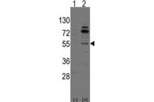 Western Blotting (WB) image for anti-Cdc42 Guanine Nucleotide Exchange Factor (GEF) 9 (Arhgef9) antibody (ABIN3001570)
