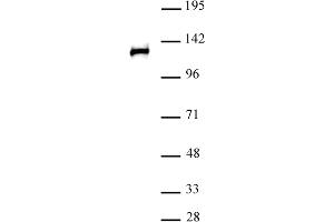 POLR2B antibody (pAb) tested by Western blot. (POLR2B 抗体  (N-Term))