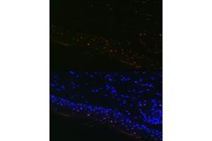 Immunofluorescence analysis of Mouse tail and ear using MITF Rabbit mAb (ABIN7268511) at dilution of 1:100 (40x lens). (MITF 抗体)