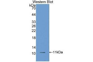 Western Blotting (WB) image for anti-beta-Thromboglobulin (beta-TG) antibody (Biotin) (ABIN1172795) (beta-Thromboglobulin 抗体  (Biotin))