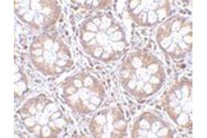 Immunohistochemistry of TEM2 in human colon tissue with this product at 2. (RASD2 抗体  (C-Term))