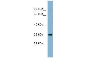 PRKRIP1 antibody used at 1 ug/ml to detect target protein. (PRKRIP1 抗体)