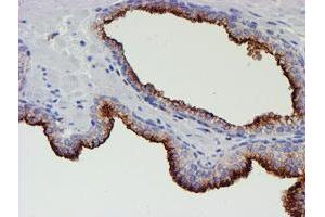 Image no. 1 for anti-Myocyte Enhancer Factor 2C (MEF2C) antibody (ABIN1499365) (MEF2C 抗体)