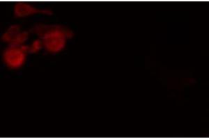 ABIN6274244 staining Hela cells by IF/ICC. (SOX6 抗体  (N-Term))
