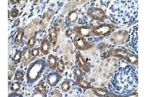 PKLR antibody was used for immunohistochemistry at a concentration of 4-8 ug/ml to stain Epithelial cells of renal tubule (arrows) in Human Kidney. (PKLR 抗体  (N-Term))
