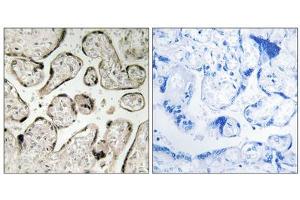Immunohistochemistry analysis of paraffin-embedded human placenta tissue using GIMAP5 antibody. (GIMAP5 抗体  (C-Term))