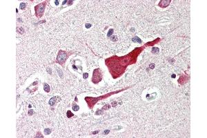 Anti-BCL2L10 / BCL-B antibody IHC of human brain, cortex. (BCL2L10 抗体  (N-Term))
