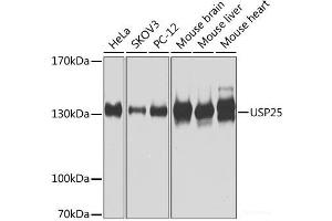 Western blot analysis of extracts of various cell lines using USP25 Polyclonal Antibody at dilution of 1:1000. (USP25 抗体)