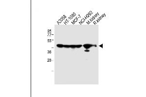 All lanes : Anti-P14 Antibody (N-term) at 1:2000 dilution Lane 1:  whole cell lysate Lane 2: HT-1080 whole cell lysate Lane 3: MCF-7 whole cell lysate Lane 4: NCI- whole cell lysate Lane 5: Mouse kidney lysate Lane 5: Rat kidney lysate Lysates/proteins at 20 μg per lane. (MMP14 抗体  (N-Term))