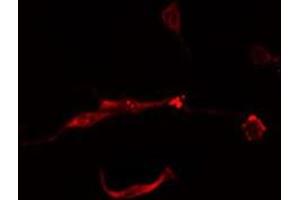ABIN6277890 staining  Hela cells by IF/ICC. (FTH1 抗体  (C-Term))