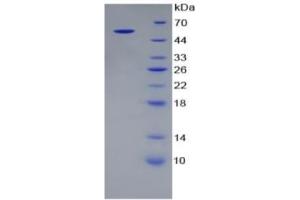 SDS-PAGE of Protein Standard from the Kit  (Highly purified E. (ALT ELISA 试剂盒)
