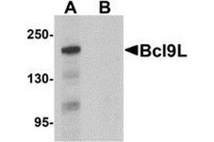 Western blot analysis of Bcl9L in HeLa cell lysate with Bcl9L antibody at 1 μg/ml in (A) the absence and (B) the presence of blocking peptide. (BCL9L 抗体  (N-Term))