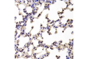 Immunohistochemistry of paraffin-embedded Mouse lung using C1R antibody at dilution of 1:100 (x400 lens). (C1R 抗体)