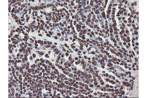 Image no. 12 for anti-F-Box Protein 21 (FBXO21) antibody (ABIN1498233) (FBXO21 抗体)