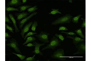 Immunofluorescence of purified MaxPab antibody to TPRKB on HeLa cell. (TPRKB 抗体  (AA 1-175))