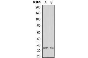 Western blot analysis of Syntaxin 1A expression in A431 (A), K562 (B) whole cell lysates. (STX1A 抗体)