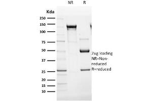 SDS-PAGE Analysis Purified Cytokeratin 14 Monoclonal Antibody (SPM263). (KRT14 抗体  (C-Term))