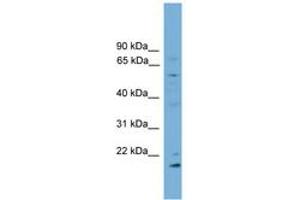 Image no. 1 for anti-Cytochrome P450, Family 2, Subfamily R, Polypeptide 1 (CYP2R1) (AA 179-228) antibody (ABIN6746310) (CYP2R1 抗体  (AA 179-228))