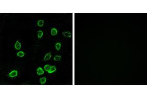 Peptide - +Immunohistochemistry analysis of paraffin-embedded human pancreas tissue using ATP5G3 antibody. (ATP5G3 抗体)