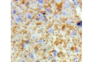 Used in DAB staining on fromalin fixed paraffin-embedded Brain tissue (SIRT2 抗体  (AA 65-340))