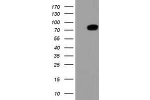 Western Blotting (WB) image for anti-Thimet Oligopeptidase 1 (THOP1) antibody (ABIN1501380) (Thimet Oligopeptidase 1 抗体)