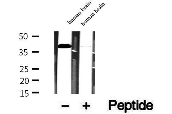 Tropomodulin 4 抗体  (Internal Region)