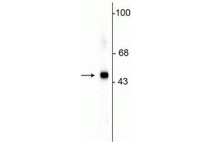 Western blot of HeLa lysate showing specific immunolabeling of the ~49 kDa SAP49 protein. (SF3B4 抗体)