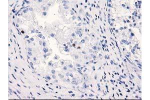 Immunohistochemistry (IHC) image for anti-Chromosome 1 Open Reading Frame 50 (C1ORF50) antibody (ABIN1497032) (C1ORF50 抗体)
