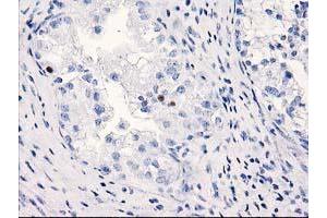 Immunohistochemistry (IHC) image for anti-Chromosome 1 Open Reading Frame 50 (C1ORF50) antibody (ABIN1497032) (C1ORF50 抗体)
