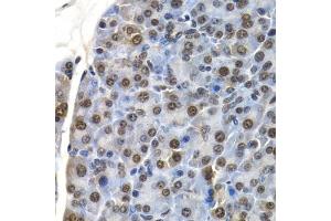 Immunohistochemistry of paraffin-embedded mouse pancreas using ID3 antibody (ABIN6130481, ABIN6142140, ABIN6142141 and ABIN6221020) at dilution of 1:200 (40x lens).