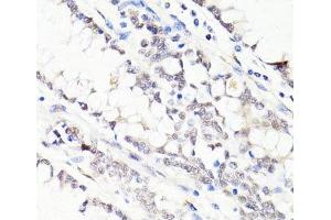 Immunohistochemistry of paraffin-embedded Human colon using FKBP5 Polyclonal Antibody at dilution of 1:100 (40x lens). (FKBP5 抗体)