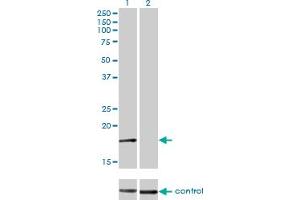 Western blot analysis of AP2S1 over-expressed 293 cell line, cotransfected with AP2S1 Validated Chimera RNAi (Lane 2) or non-transfected control (Lane 1). (AP2S1 抗体  (AA 1-142))